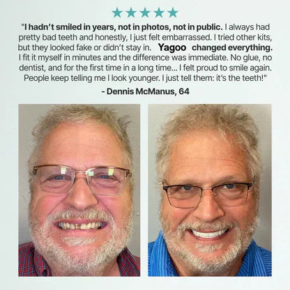 ⏰Ends Today: 70% OFF! 🌎KLENIMORE™ Custom-Fit  Dentures— Designed for Comfort and a Natural-Looking Smile