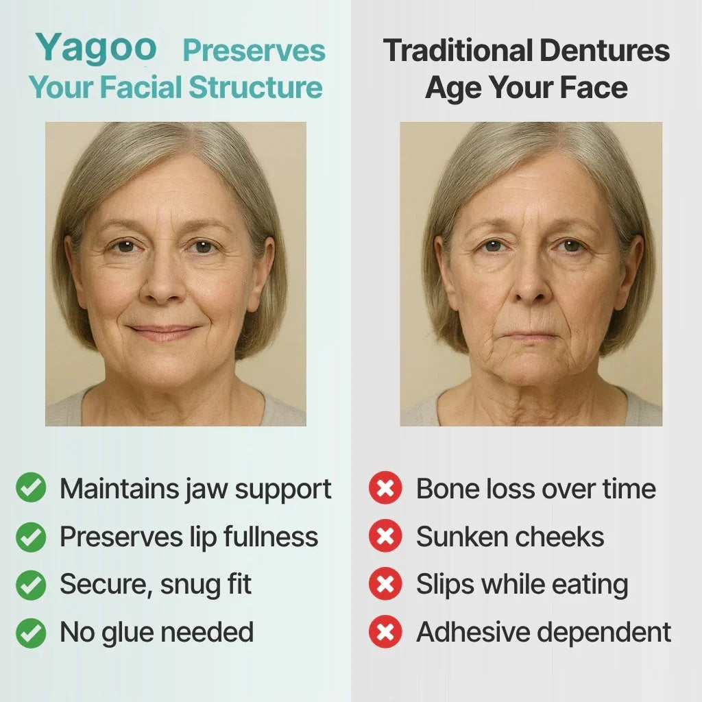 ⏰Ends Today: 70% OFF! 🌎KLENIMORE™ Custom-Fit  Dentures— Designed for Comfort and a Natural-Looking Smile