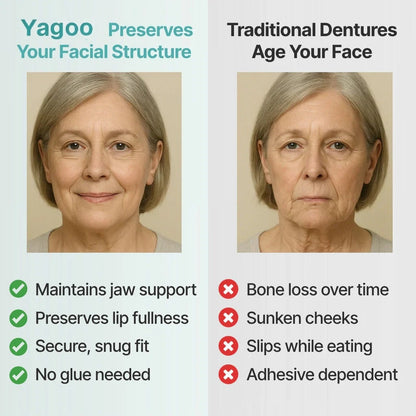⏰Ends Today: 70% OFF! 🌎KLENIMORE™ Custom-Fit  Dentures— Designed for Comfort and a Natural-Looking Smile