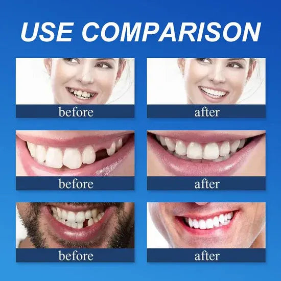 ⏰Ends Today: 70% OFF! 🌎KLENIMORE™ Custom-Fit  Dentures— Designed for Comfort and a Natural-Looking Smile